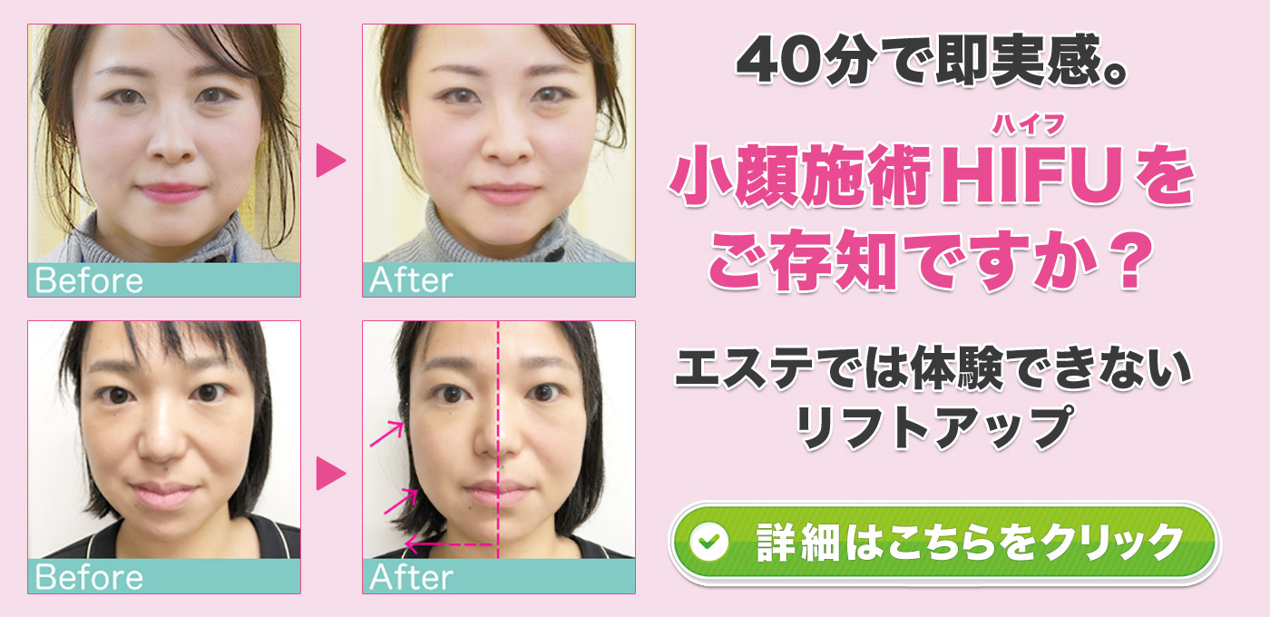 40分で即実感。小顔施術 HIFU（ハイフ）をご存知ですか？エステでは体験できないリフトアップ