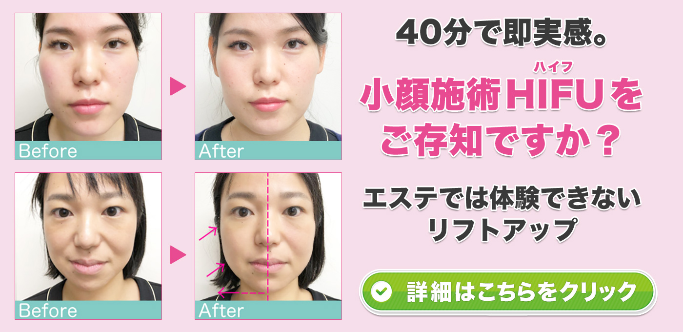 40分で即実感。小顔施術 HIFU（ハイフ）をご存知ですか？エステでは体験できないリフトアップ