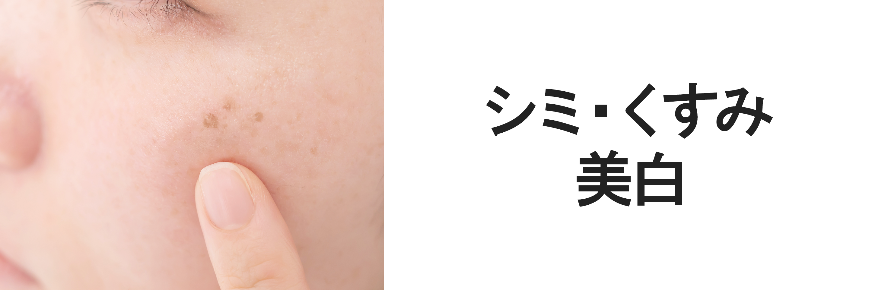 シミ・くすみ・美白